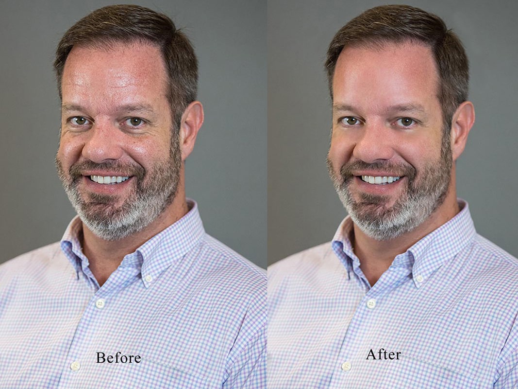 Professional Retouching before and after example by Photographer's Edit Studio